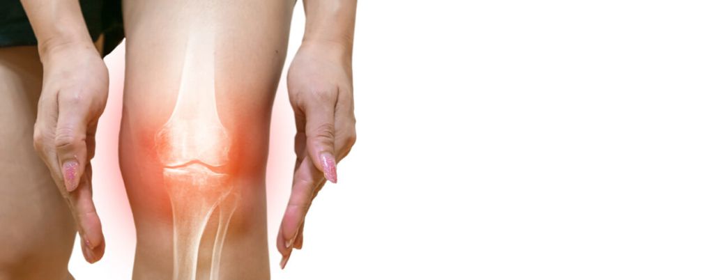 Knee arthritis symptoms: Signs, types, treatment, and more