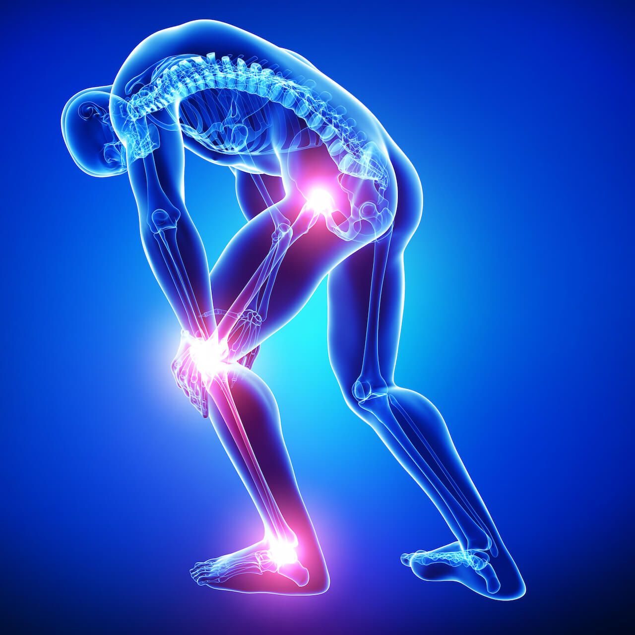 Joint inflammation: Causes, treatment, and symptoms