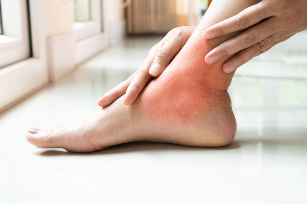 Gout in ankle: Symptoms, treatment, and more